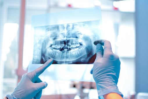 Image of digital radiography at Reich Dental Center - Roswell.